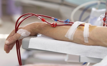 What is Dialysis and When do Patients Require Dialysis?
